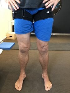 Cellular Swelling Post Blood Flow Restriction Training